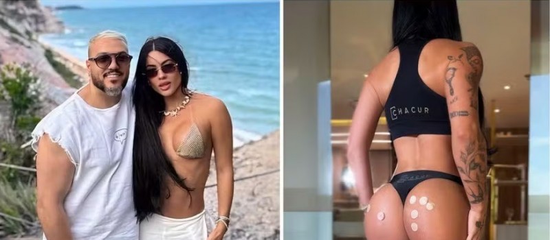 Namorada de Belo, Rayane Figliuzzi exibe 'bumbum harmonizado'