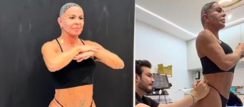 Gretchen mostra tratamento contra flacidez no rosto, pernas e bumbum