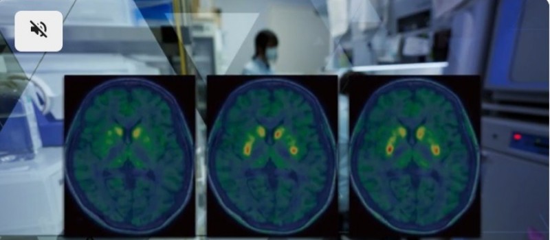 EUA aprovam rem�dio para Parkinson que age de jeito in�dito no c�rebro