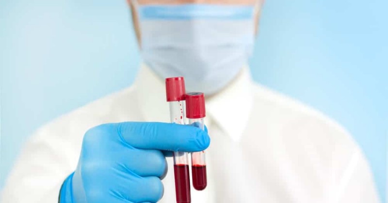 Estudo brasileiro cria exame de sangue para detectar c�ncer de mama