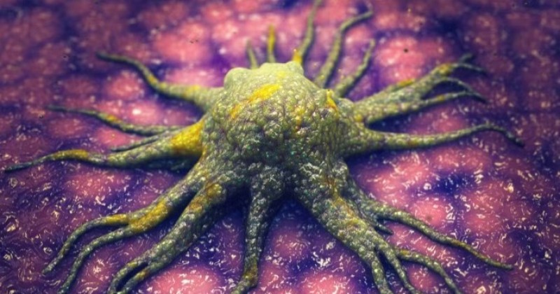 Cientistas descobrem mol�cula que 'mata de fome' c�lulas cancer�genas sem afetar tecidos 