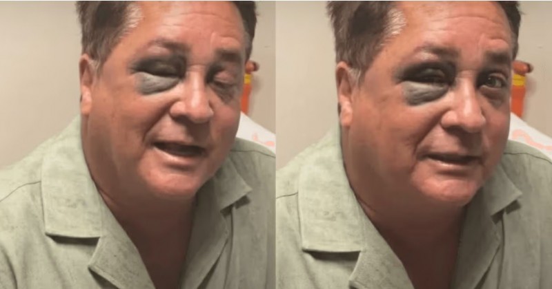 Leonardo sofre acidente em pescaria e aparece com olho roxo