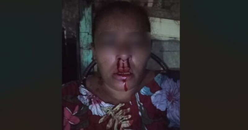Mulher � brutalmente espancada por primo ao tentar intervir em caso de viol�ncia contra outra mulher em Patos