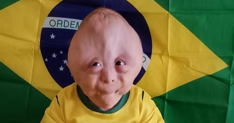 Fam�lia da Para�ba viraliza ao mostrar rotina e desafios de filho que nasceu com m�ltiplas malforma��es