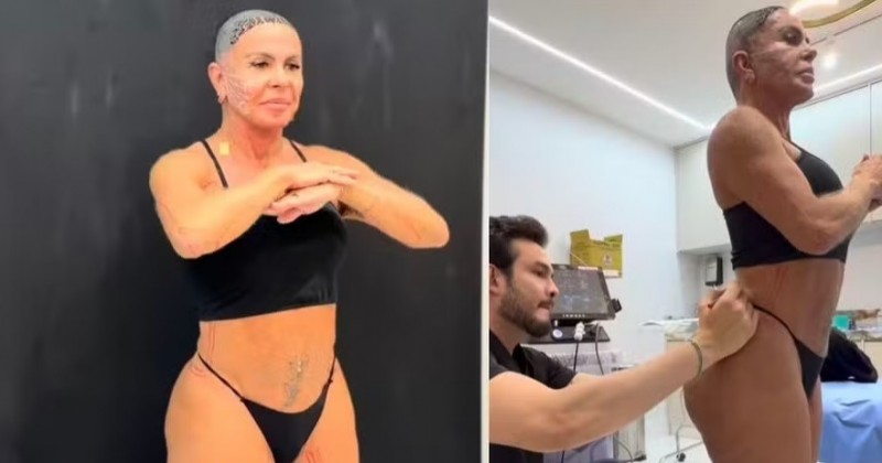 Gretchen mostra tratamento contra flacidez no rosto, pernas e bumbum