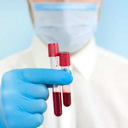 Estudo brasileiro cria exame de sangue para detectar c�ncer de mama