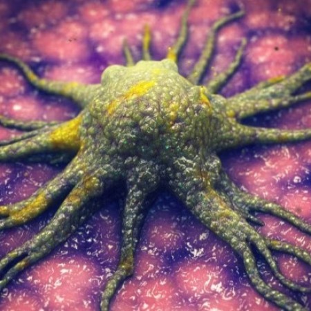 Cientistas descobrem mol�cula que 'mata de fome' c�lulas cancer�genas sem afetar tecidos 