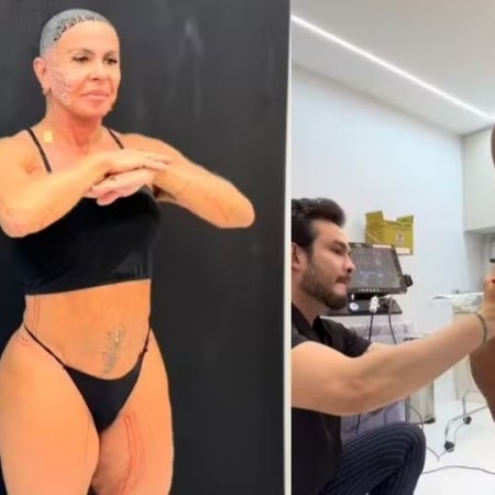 Gretchen mostra tratamento contra flacidez no rosto, pernas e bumbum