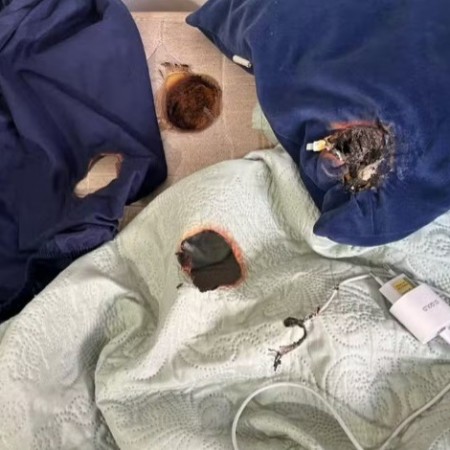 Carregador de celular pega fogo e queima colch�o enquanto jovem dormia, em Jo�o Pessoa