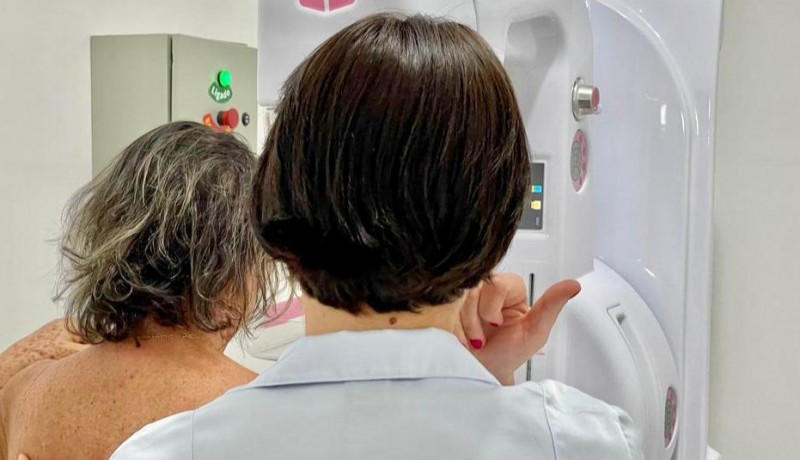 Lei garante mamografia pelo SUS para mulheres a partir dos 40 anos