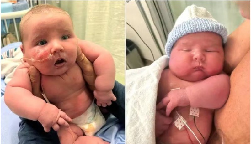 Pais ficam chocados ap�s filho nascer com mais de 7kg no Canad�