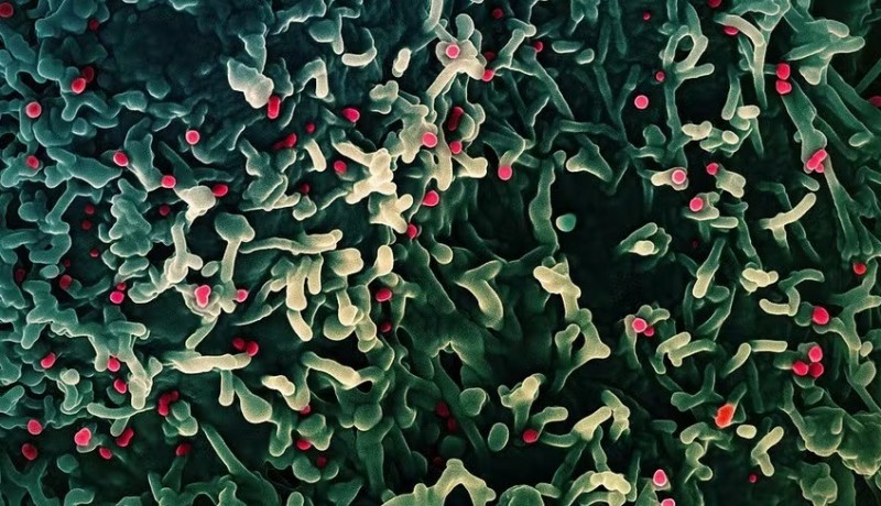 Para�ba investiga caso suspeito de Mpox de turista do Rio Grande do Norte