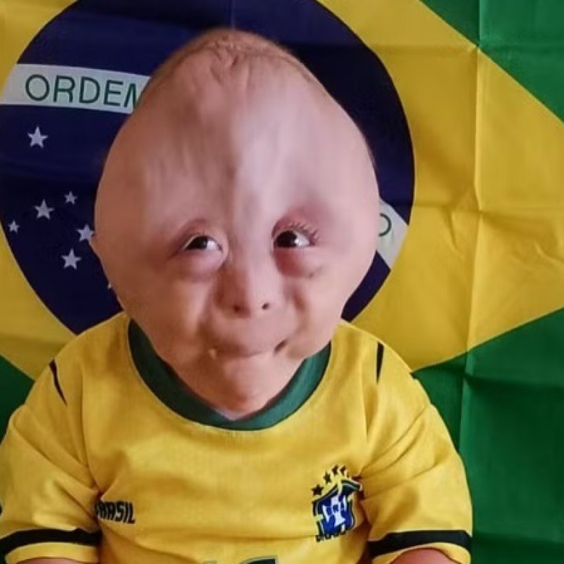 Fam�lia da Para�ba viraliza ao mostrar rotina e desafios de filho que nasceu com m�ltiplas malforma��es